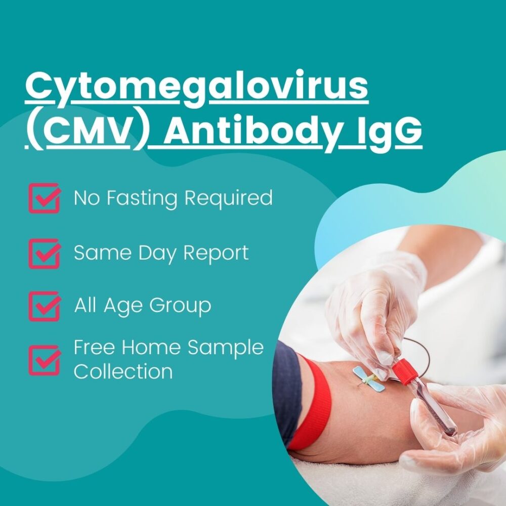 Cytomegalovirus (CMV) Antibody IgG Test in Cuttack - Clinic At Home
